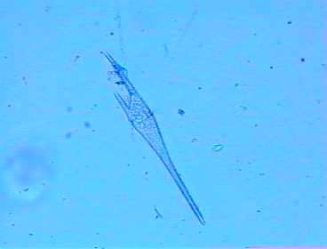 Ceratium sp.