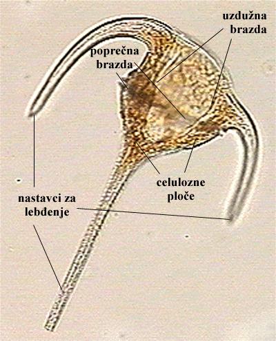 Ceratium sp. - vanjski izgled - celulozne ploče