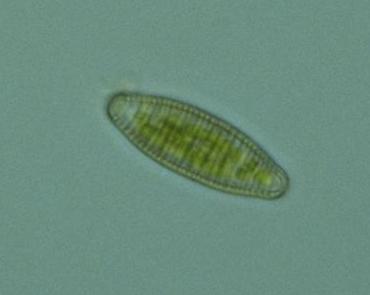 Diatoma sp.