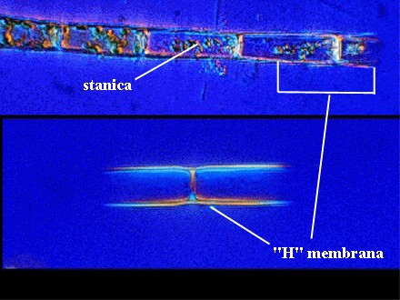 Tribonema sp. - stanica - H membrana