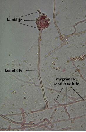Aspergillus sp. - slika 3