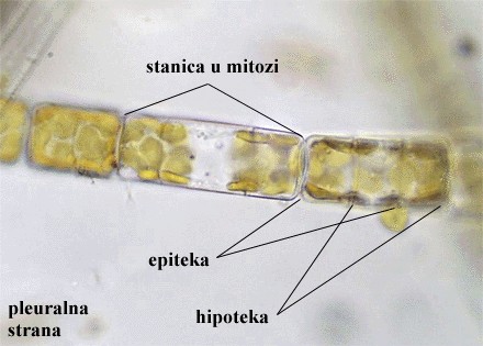 Melosira sp. - slika 1