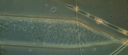 Rhizosolenia sp.