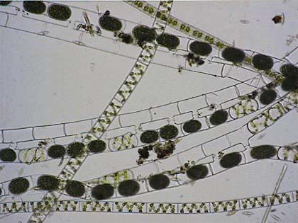 Spirogyra sp.